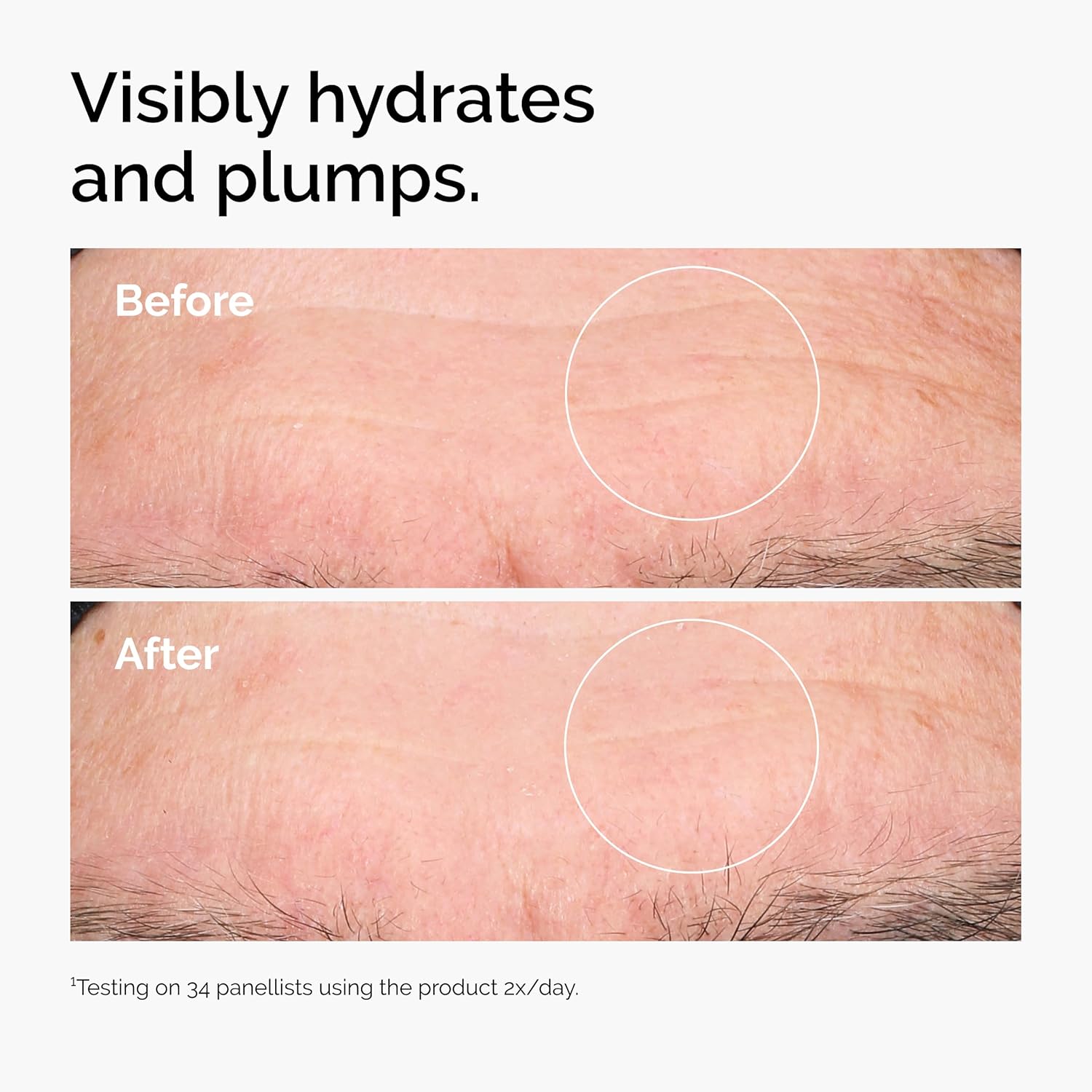 Before and after skin hydration results from 34 panellists using The Ordinary Hyaluronic Acid twice daily