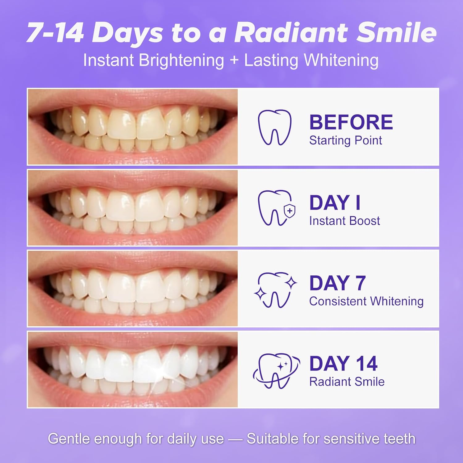 Pdoo progress chart comparing teeth before treatment and at day 1, day 7 and day 14