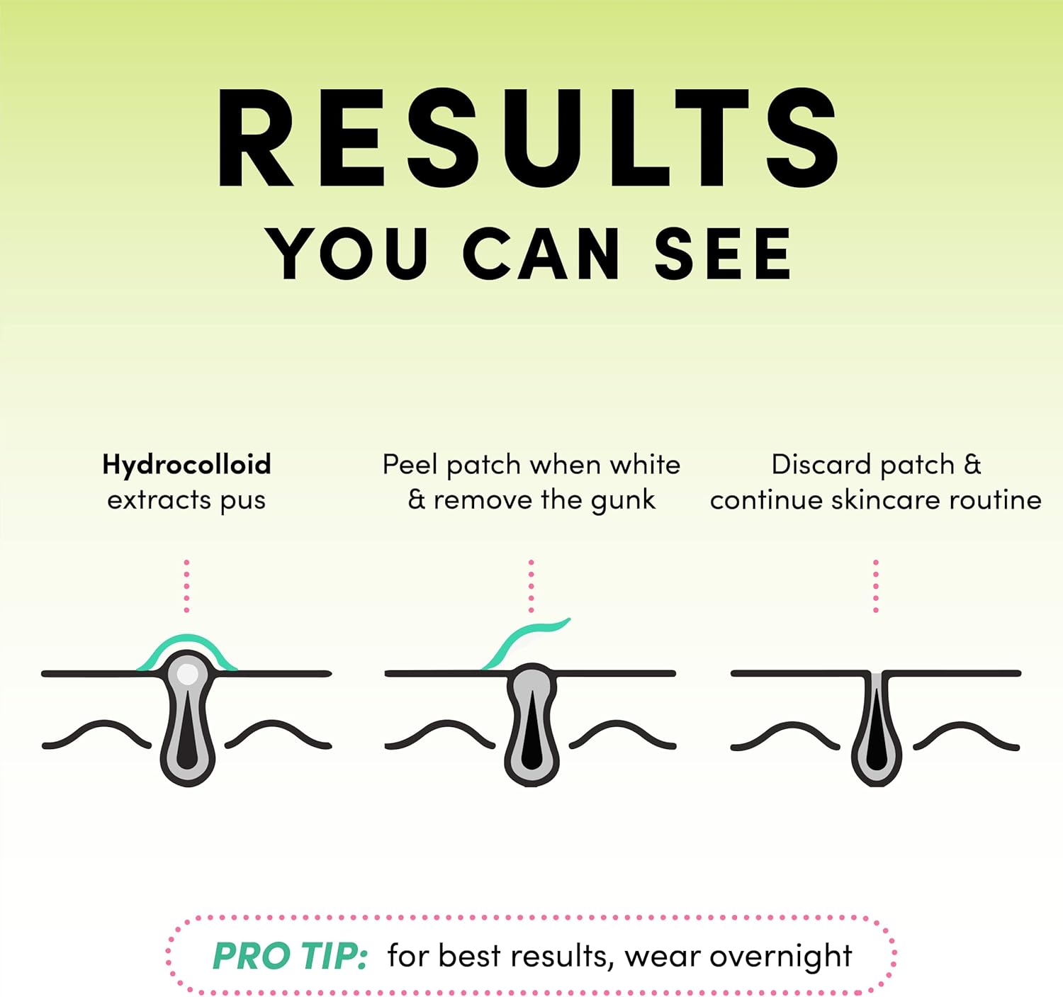Angled view of the Dots for Spots Patches pack showing the hydrocolloid patch sheet