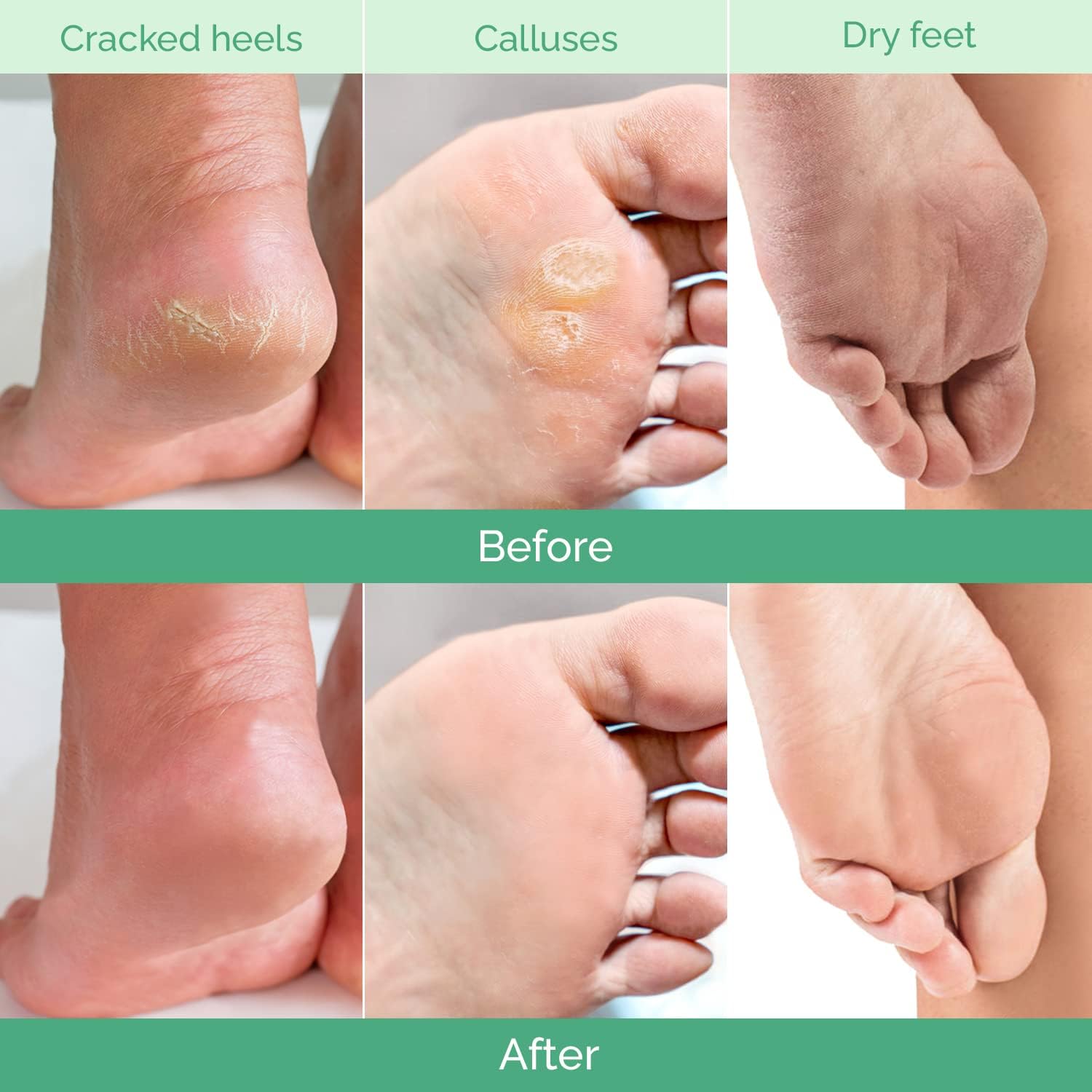 Angle view of the Plantifique peach foot peel mask packaging and contents