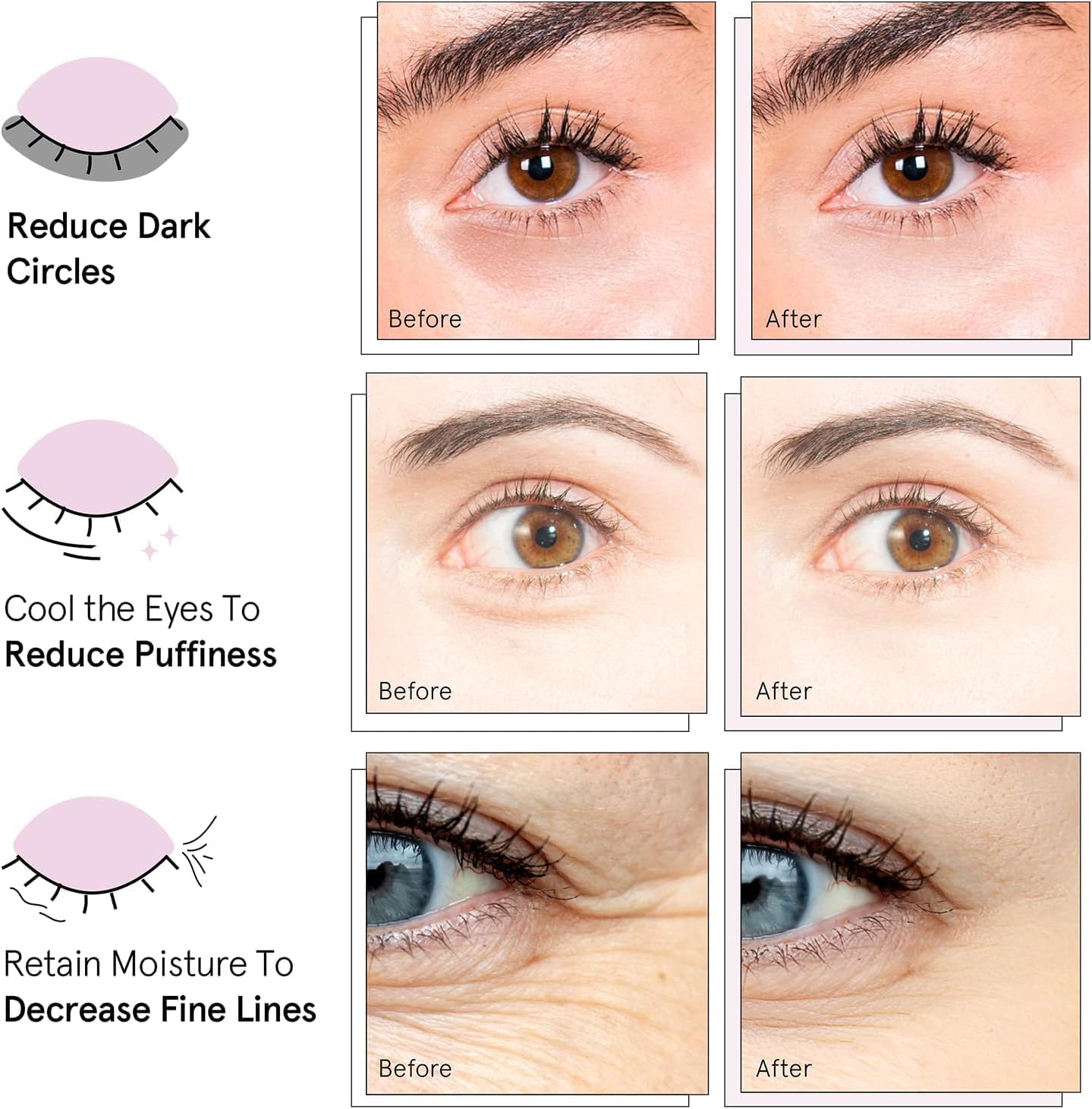 Before and after comparison panels for dark circles, puffiness and fine lines