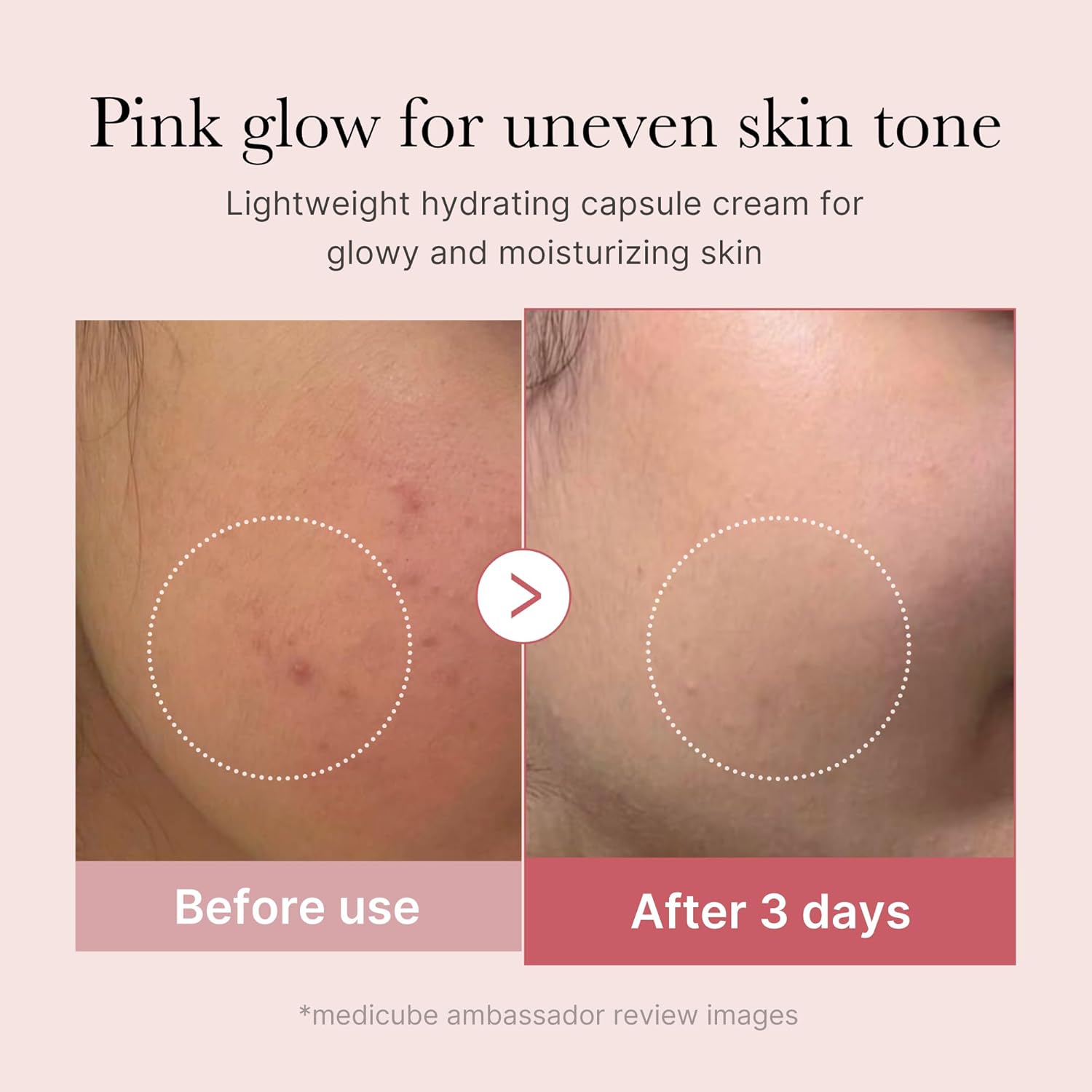 medicube before and after comparison showing skin texture before use and after three days, from ambassador review images