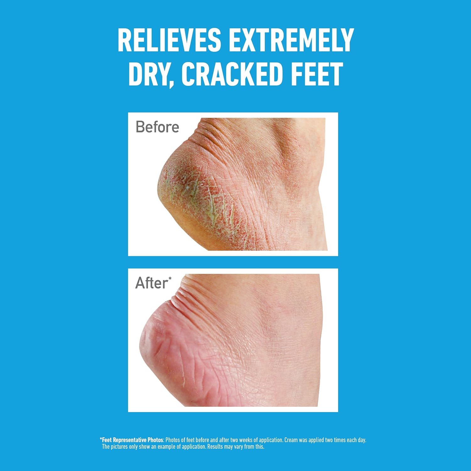 O'Keeffe's Healthy Feet foot cream tub with its blue textured lid on a plain surface