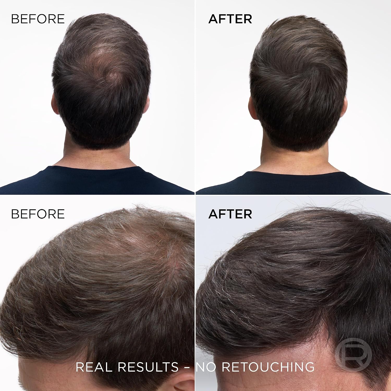 Listing before and after of a man's thinning crown looking fuller after Magic Retouch