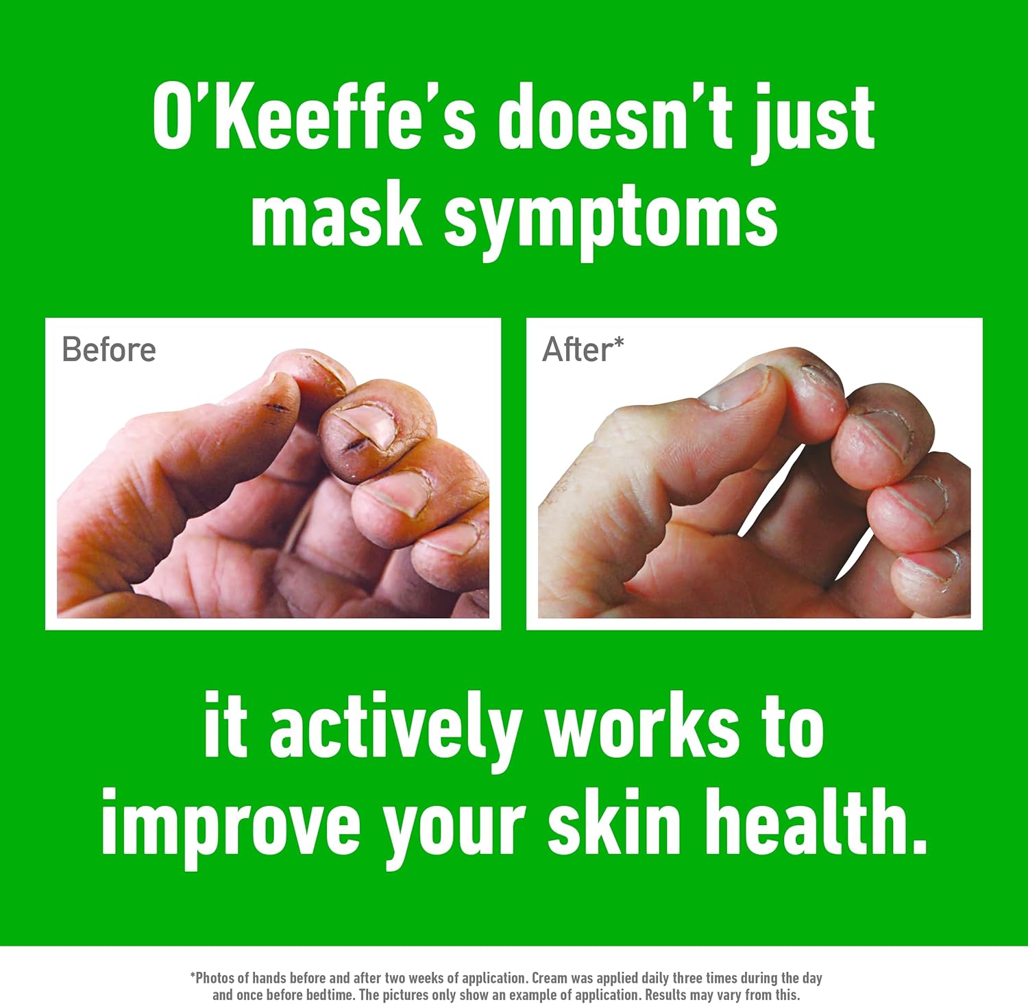 Before and after comparison showing improvement in dry cracked hands after using O'Keeffe's Working Hands