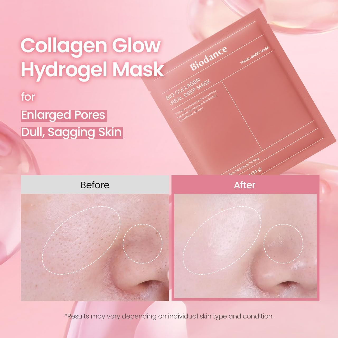 Before and after comparison showing pore refinement results from BIODANCE Bio-Collagen mask