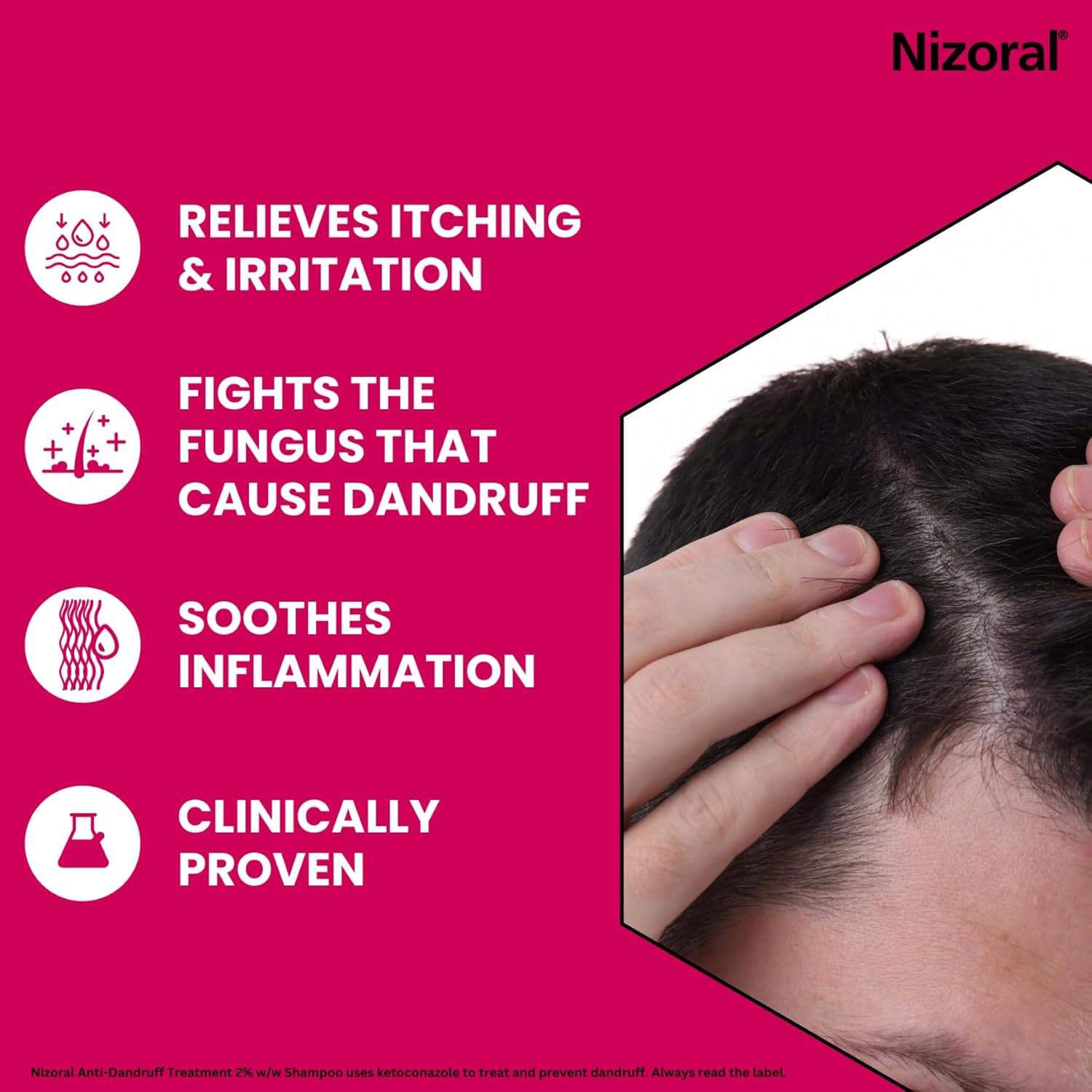 Nizoral key scalp benefits infographic showing itch relief, flake removal, and inflammation soothing